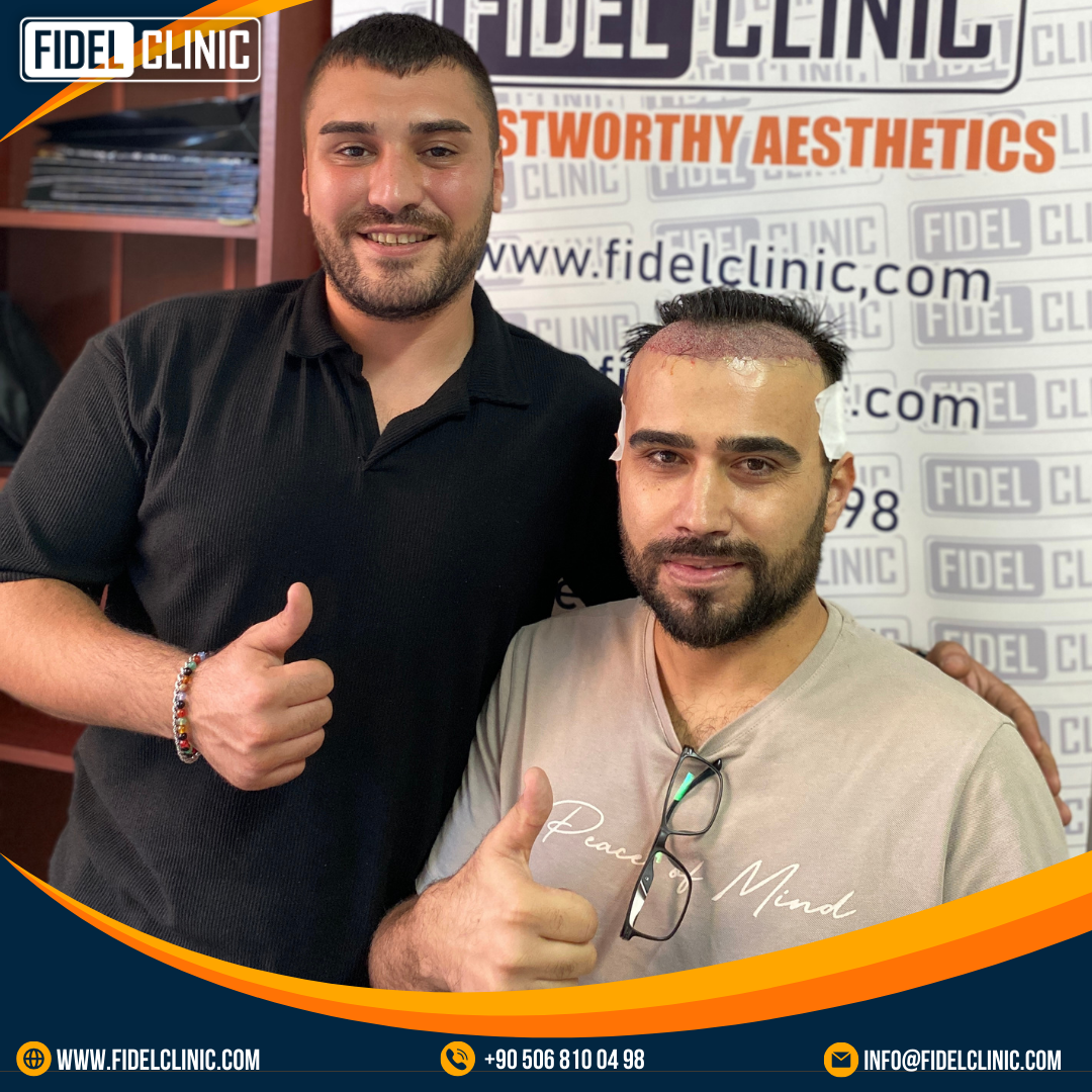 saç ekiminin faydaları