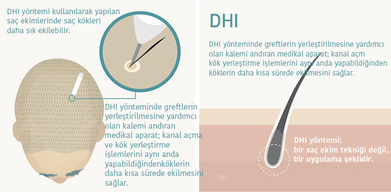 saç ekiminin faydaları